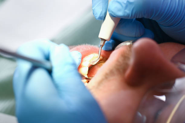 Best Dentist for Tooth Abscess  in Swansboro, NC