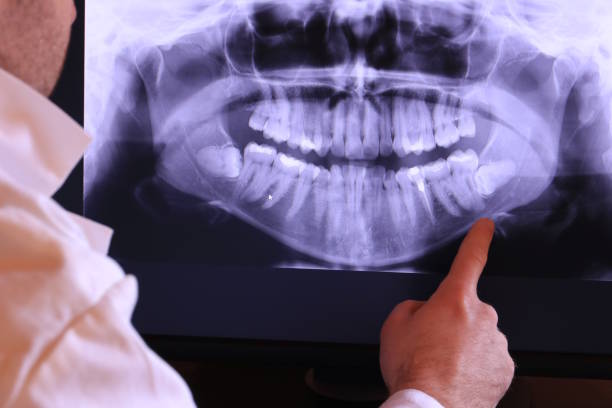 Best Teeth Whitening  in Swansboro, NC