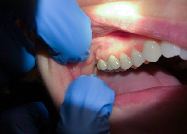 Best Emergency Gum Pain Relief  in Swansboro, NC