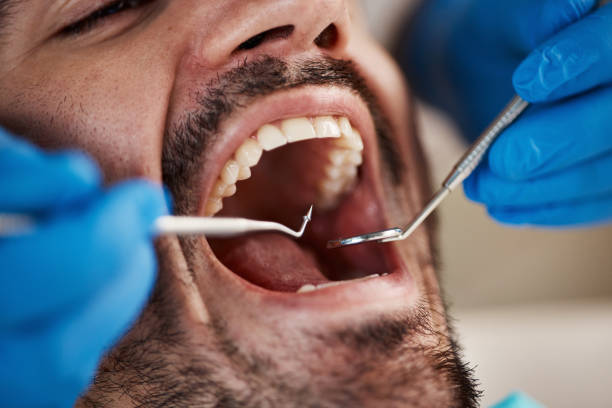 Best Knocked-Out Tooth Emergency  in Swansboro, NC